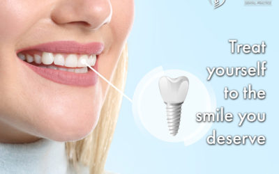 Treat yourself to the smile you deserve