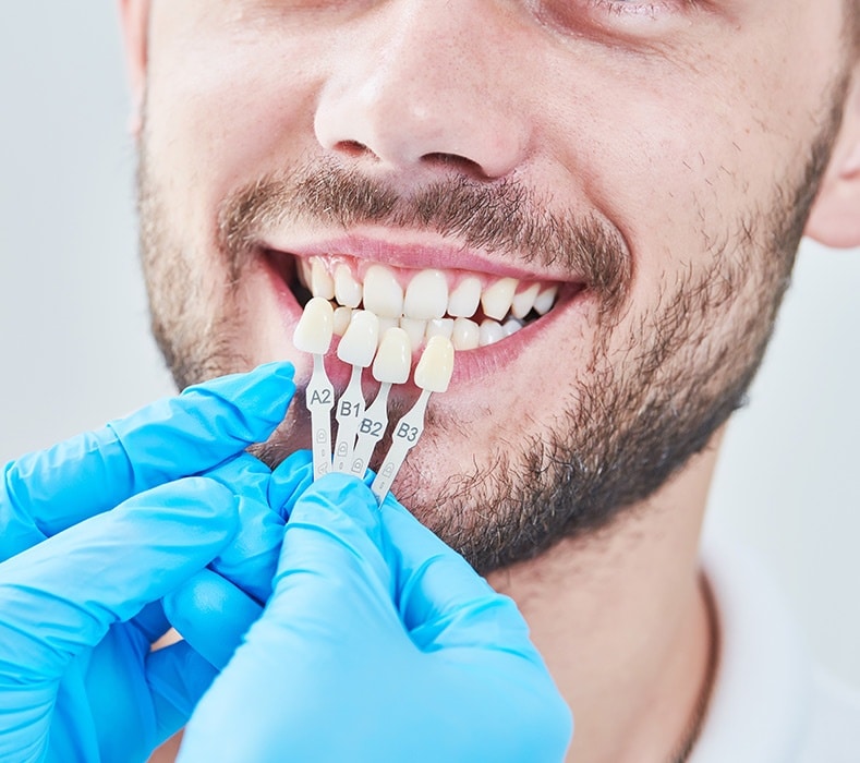 Dental_Implants