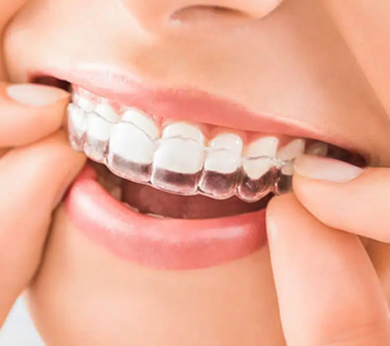 Cosmetic dentistry